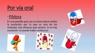 Por vía oral
-Píldora
Es una pastilla que con su toma diaria inhibe
la ovulación por lo que es uno de los
métodos más eficaces que existen. Si no hay
ovulación no puede haber embarazo
 