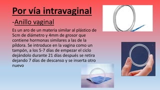 Por vía intravaginal
-Anillo vaginal
Es un aro de un materia similar al plástico de
5cm de diámetro y 4mm de grosor que
contiene hormonas similares a las de la
píldora. Se introduce en la vagina como un
tampón, a los 5-7 días de empezar el ciclo
dejándolo durante 21 días después se retira
dejando 7 días de descanso y se inserta otro
nuevo
 