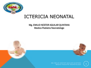 M G E M I L I O N E S T O R A G U I L A R Q U I N T A N A
M E D I C O P E D I A T R A N E O N A T O L O G O 1
Mg. EMILIO NESTOR AGUILAR QUINTANA
Medico Pediatra Neonatologo
ICTERICIA NEONATAL
 