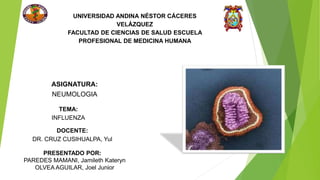 UNIVERSIDAD ANDINA NÉSTOR CÁCERES
VELÁZQUEZ
FACULTAD DE CIENCIAS DE SALUD ESCUELA
PROFESIONAL DE MEDICINA HUMANA
ASIGNATURA:
NEUMOLOGIA
TEMA:
INFLUENZA
DOCENTE:
DR. CRUZ CUSIHUALPA, Yul
PRESENTADO POR:
PAREDES MAMANI, Jamileth Kateryn
OLVEA AGUILAR, Joel Junior
 