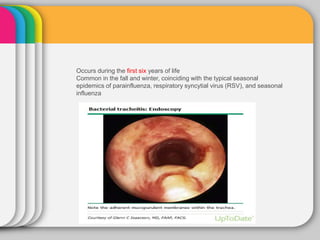 Occurs during the first six years of life
Common in the fall and winter, coinciding with the typical seasonal
epidemics of parainfluenza, respiratory syncytial virus (RSV), and seasonal
influenza
 