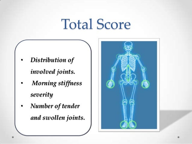 Undifferentiated Arthritis - Undifferentiated connective tissue disea…