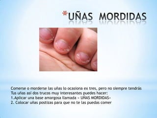 *




Comerse o morderse las uñas lo ocasiona ex tres, pero no siempre tendrás
Tus uñas así dos trucos muy interesantes puedes hacer:
1.Aplicar una base amargosa llamada « UÑAS MORDIDAS»
2. Colocar uñas postizas para que no te las puedas comer
 