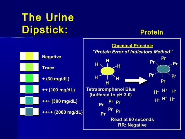 test pregnancy blood strip urinalyisisreview Ua test pregnancy blood strip urinalyisisreview Ua