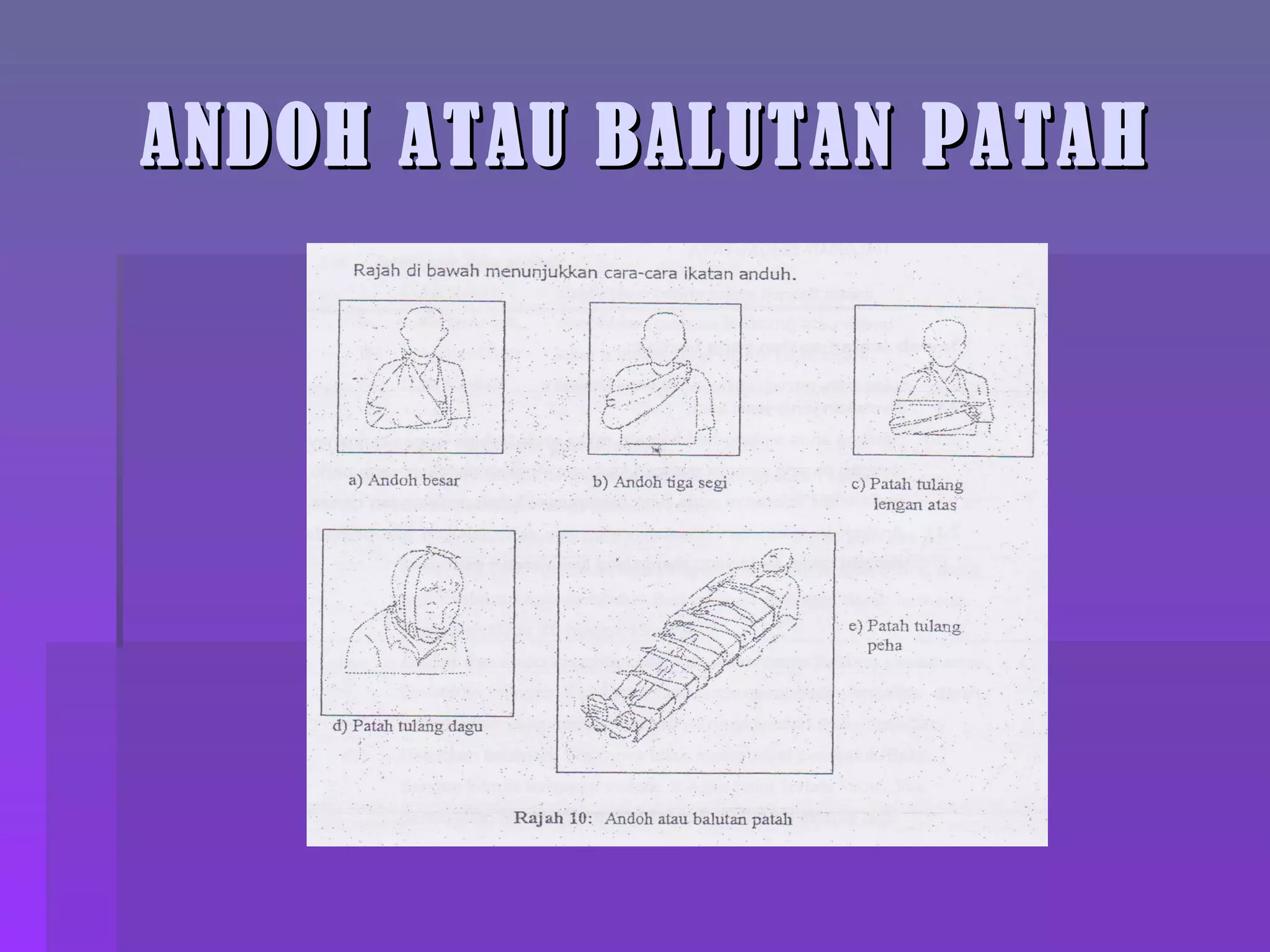 ANDOH ATAU BALUTAN PATAH 