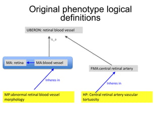 MA:blood vessel
UBERON: retinal blood vessel
MP:abnormal retinal blood vessel
morphology
Inheres in
is_a
MA: retina
HP: Central retinal artery vascular
tortuosity
FMA:central retinal artery
Inheres in
Original phenotype logical
definitions
 