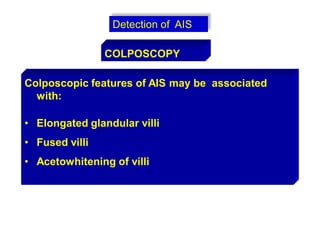 Detection of AIS
COLPOSCOPY
Colposcopic features of AIS may be associated
with:
• Elongated glandular villi
• Fused villi
• Acetowhitening of villi
 