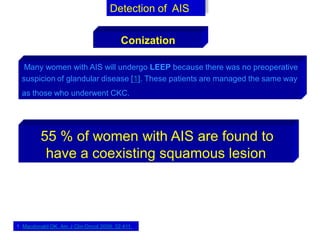 Many women with AIS will undergo LEEP because there was no preoperative
suspicion of glandular disease [1]. These patients are managed the same way
as those who underwent CKC.
Detection of AIS
Conization
55 % of women with AIS are found to
have a coexisting squamous lesion
1. Macdonald OK, Am J Clin Oncol 2009; 32:411.
 