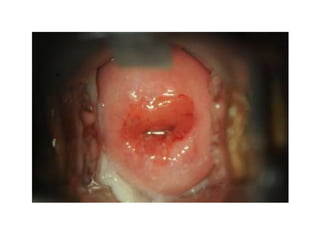 3  dr mario sideri  ais