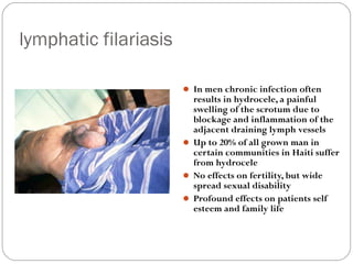 lymphatic filariasis

                        In men chronic infection often
                         results in hydrocele, a painful
                         swelling of the scrotum due to
                         blockage and inflammation of the
                         adjacent draining lymph vessels
                        Up to 20% of all grown man in
                         certain communities in Haiti suffer
                         from hydrocele
                        No effects on fertility, but wide
                         spread sexual disability
                        Profound effects on patients self
                         esteem and family life
 