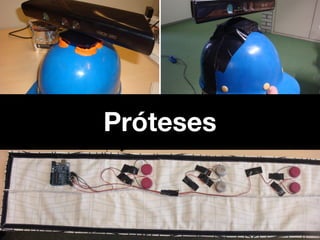 Próteses
 