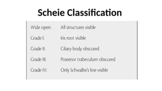 Scheie Classification System UBM and Gonioscopy in glaucoma pts .pptx