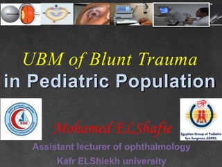 UBM of Blunt Trauma
in Pediatric Population
Mohamed ELShafie
Assistant lecturer of ophthalmology
Kafr ELShiekh university
 