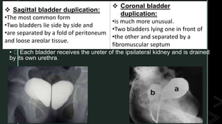 z
• Each bladder receives the ureter of the ipsilateral kidney and is drained
by its own urethra.
 Sagittal bladder duplication:
•The most common form
•Two bladders lie side by side and
•are separated by a fold of peritoneum
and loose areolar tissue.
 Coronal bladder
duplication:
•is much more unusual.
•Two bladders lying one in front of
•the other and separated by a
fibromuscular septum
 