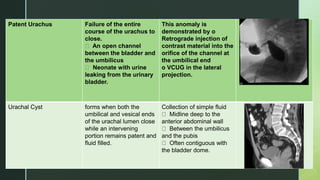 z
Patent Urachus Failure of the entire
course of the urachus to
close.
An open channel
between the bladder and
the umbilicus
Neonate with urine
leaking from the urinary
bladder.
This anomaly is
demonstrated by o
Retrograde injection of
contrast material into the
orifice of the channel at
the umbilical end
o VCUG in the lateral
projection.
Urachal Cyst forms when both the
umbilical and vesical ends
of the urachal lumen close
while an intervening
portion remains patent and
fluid filled.
Collection of simple fluid
Midline deep to the
anterior abdominal wall
Between the umbilicus
and the pubis
Often contiguous with
the bladder dome.
 