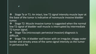 z
 Stage Ta or T1: An intact, low T2 signal intensity muscle layer at
the base of the tumor is indicative of nonmuscle invasive bladder
tumor.
 Stage T2: Muscle invasive tumor is suggested when the normal
low T2 signal of bladder wall muscle is interrupted by intermediate
T2 tumor signal.
 Stage T3a (microscopic perivesical invasion) diagnosis is
difficult.
 Stage T3b: A bladder wall lesion with an irregular, shaggy outer
border and streaky areas of the same signal intensity as the tumor
in perivesical fat.
 