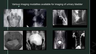 z
Various imaging modalities available for imaging of urinary bladder
 