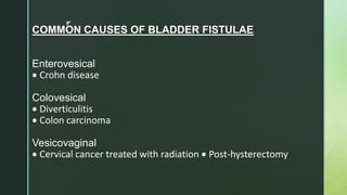 z
COMMON CAUSES OF BLADDER FISTULAE
Enterovesical
 Crohn disease
Colovesical
 Diverticulitis
 Colon carcinoma
Vesicovaginal
 Cervical cancer treated with radiation  Post-hysterectomy
 