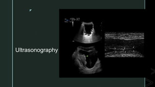 z
Ultrasonography
 