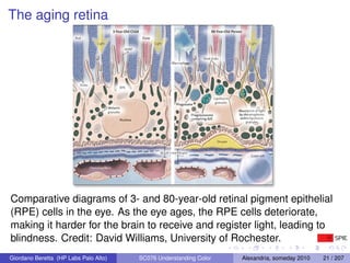 The aging retina




Comparative diagrams of 3- and 80-year-old retinal pigment epithelial
(RPE) cells in the eye. As the ...