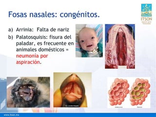 Fosas nasales: congénitos.
a) Arrinia: Falta de nariz
b) Palatosquisis: fisura del
paladar, es frecuente en
animales domésticos =
neumonía por
aspiración.
 