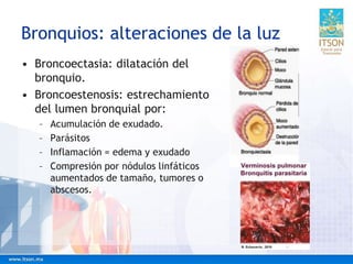 Bronquios: alteraciones de la luz
• Broncoectasia: dilatación del
bronquio.
• Broncoestenosis: estrechamiento
del lumen bronquial por:
– Acumulación de exudado.
– Parásitos
– Inflamación = edema y exudado
– Compresión por nódulos linfáticos
aumentados de tamaño, tumores o
abscesos.
 