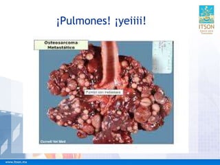 ¡Pulmones! ¡yeiiii!
 