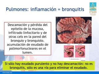 Pulmones: inflamación = bronquitis
Descamación y pérdida del
epitelio de la mucosa,
infiltrado linfocitario y de
otras cels en la pared del
bronquio y bronquiolo.
acumulación de exudado de
polimorfonucleares en el
lumen.
Si sólo hay exudado purulento y no hay descamación: no es
bronquitis, sólo es una vía para eliminar el exudado.
 