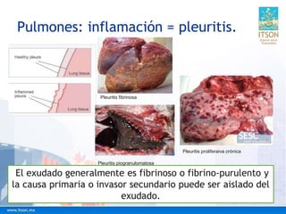 Pulmones: inflamación = pleuritis.
El exudado generalmente es fibrinoso o fibrino-purulento y
la causa primaria o invasor secundario puede ser aislado del
exudado.
Pleuritis piogranulomatosa
Pleuritis proliferaiva crónica
Pleuritis fibrinosa
 