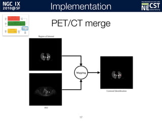 Automating Lung Cancer Identification in PET/CT Imaging | PPT