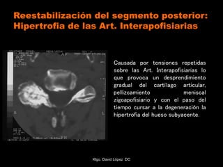 Reestabilización del segmento posterior:
Hipertrofia de las Art. Interapofisiarias
Causada por tensiones repetidas
sobre las Art. Interapofisiarias lo
que provoca un desprendimiento
gradual del cartílago articular,
pellizcamiento meniscal
zigoapofisiario y con el paso del
tiempo cursar a la degeneración la
hipertrofia del hueso subyacente.
Klgo. David López DC
 