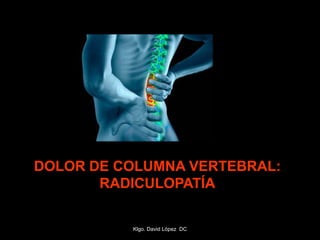 DOLOR DE COLUMNA VERTEBRAL:
RADICULOPATÍA
Klgo. David López DC
 