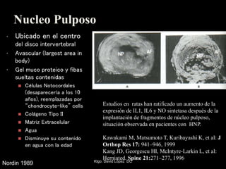 Nucleo Pulposo
• Ubicado en el centro
del disco intervertebral
• Avascular (largest area in
body)
• Gel muco proteico y fibas
sueltas contenidas
 Células Notocordales
(desaparecería a los 10
años), reemplazadas por
“chondrocyte-like” cells
 Colágeno Tipo II
 Matriz Extracelular
 Agua
 Disminuye su contenido
en agua con la edad
Nordin 1989
Estudios en ratas han ratificado un aumento de la
expresión de IL1, IL6 y NO sintetasa después de la
implantación de fragmentos de núcleo pulposo,
situación observada en pacientes con HNP.
Kawakami M, Matsumoto T, Kuribayashi K, et al: J
Orthop Res 17: 941–946, 1999
Kang JD, Georgescu HI, McIntyre-Larkin L, et al:
Herniated. Spine 21:271–277, 1996
Klgo. David López DC
 