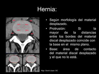 Hernia:
• Según morfología del material
desplazado.
• Protrusión: Si la
mayor de la distancias
entre los bordes del material
discal desplazado coincide con
la base en el mismo plano.
• Base: área de contacto
del material discal desplazado
y el que no lo está.
Klgo. David López DC
 