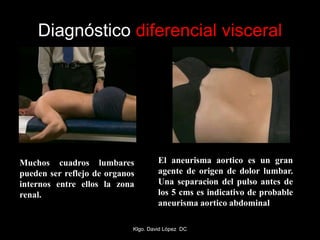 Diagnóstico diferencial visceral
Muchos cuadros lumbares
pueden ser reflejo de organos
internos entre ellos la zona
renal.
El aneurisma aortico es un gran
agente de origen de dolor lumbar.
Una separacion del pulso antes de
los 5 cms es indicativo de probable
aneurisma aortico abdominal
Klgo. David López DC
 