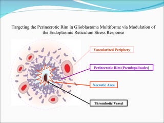 Targeting the Perinecrotic Rim in Glioblastoma Multiforme via Modulation of the Endoplasmic Reticulum Stress Response Vascularized Periphery Perinecrotic Rim (Pseudopalisades ) Necrotic Area Thrombotic Vessel 