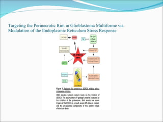 Targeting the Perinecrotic Rim in Glioblastoma Multiforme via  Modulation of the Endoplasmic Reticulum Stress Response 