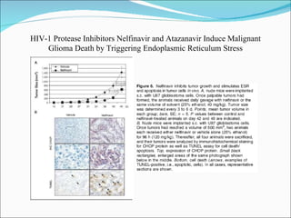 HIV-1 Protease Inhibitors Nelfinavir and Atazanavir Induce Malignant Glioma Death by Triggering Endoplasmic Reticulum Stress 