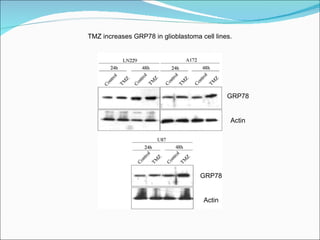 TMZ increases GRP78 in glioblastoma cell lines. GRP78 Actin GRP78 Actin 
