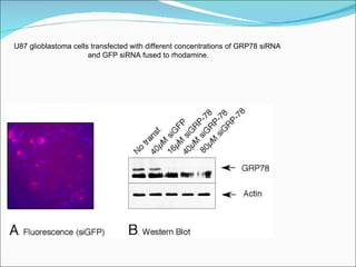 U87 glioblastoma cells transfected with different concentrations of GRP78 siRNA  and GFP siRNA fused to rhodamine. 