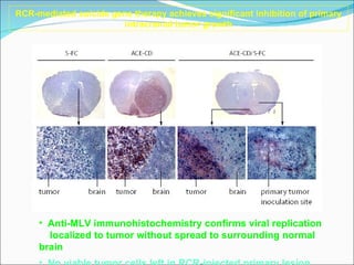 RCR-mediated suicide gene therapy achieves significant inhibition of primary intracranial tumor growth Anti-MLV immunohistochemistry confirms viral replication localized to tumor without spread to surrounding normal brain No viable tumor cells left in RCR-injected primary lesion 