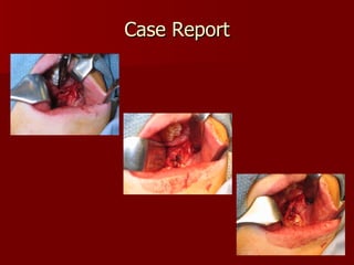Case Report *Images courtesy of Dr. Donoff 