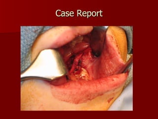 Case Report 