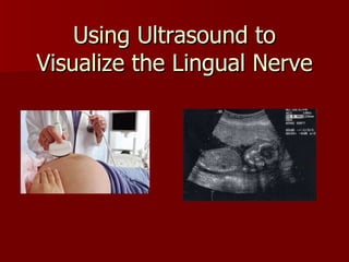 Using Ultrasound to Visualize the Lingual Nerve http://www.bbc.co.uk/health/images/300/ultrasound.jpg 