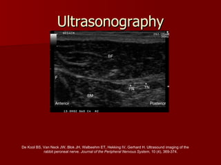 Ultrasonography De Kool BS, Van Neck JW, Blok JH, Walbeehm ET, Hekking IV, Gerhard H. Ultrasound imaging of the  rabbit peroneal nerve.  Journal of the Peripheral Nervous System , 10 (4), 369-374. PN, peroneal nerve; TN, tibial nerve; BF, biceps femoris muscle;  SM, semimembranosus muscle; F, femur  
