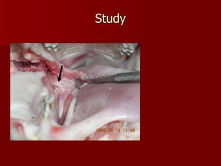 Study Yorkshire  cadaver pig head 