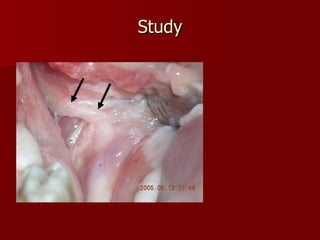 Study Yorkshire  cadaver pig head 