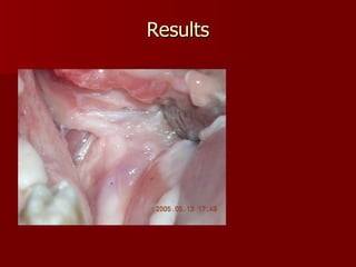 Results Yorkshire  cadaver pig head 