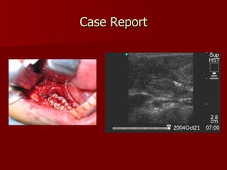 Case Report *Images courtesy of Dr. Donoff 