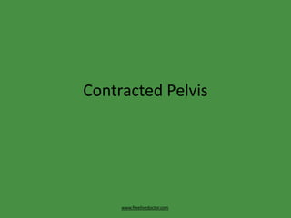 Contracted Pelvis
www.freelivedoctor.com
 